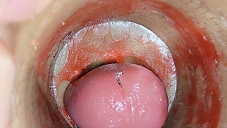 Camera Inside Deep Pussy Captures Big dose Ejaculation of Sperm ASMR