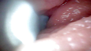 First time: An endoscope reveals the G-spot up close - without mountingl