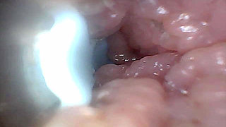 Visual Guide to G-spot Stimulation and Orgasm - Endoscopic Perspective