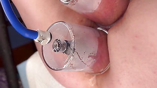 Extreme Anal & Pussy Pumping Training