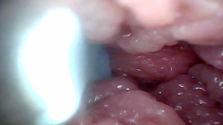 Endoscope Camera Shows the Most Sensitive Parts of the Penis Educational Video