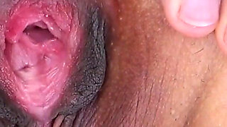 Gaping Asshole Extreme Close up