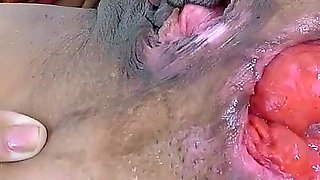 Exl-032: Huge Speculum in Ass N Pussy. Huge Prolapse and Huge Cervix. Full Extremelatina Scene Exl-032
