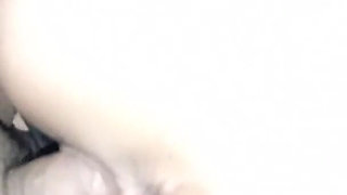 How Nice It Is to Take a Semen Sample From a Patient, It's Better to Suck It to Get the Sample