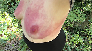 Red breasts in the forest