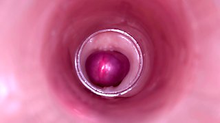 Female Insemination - Internal Camera Captures Deep Male Ejaculation