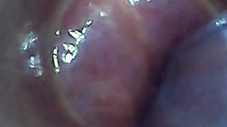 Endoscope POV: Test Tube Cock Urethral Insertion