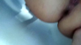 Margot Pees with a Big Bruise on Her Leg