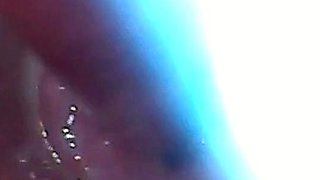 Endoscope POV: Test Tube Cock Urethral Insertion