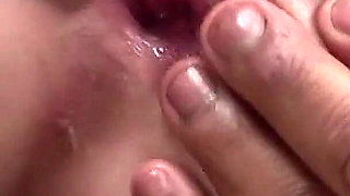 Nurse Lola with a Hairy Pussy From the BBC Gets Fucked in an Interracial Anal Encounter