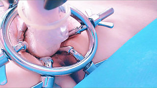 Speculum