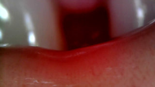 Medical Endoscope Oral Exam: Gummy Chewing, Extreme Teeth & Tongue Macro