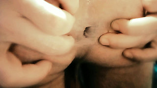 The Hot Lips Of My Ass Want Your Lips