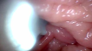 Teen POV: Endoscope G-Spot Close-Up – First Time Deep Pussy Exam