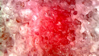 Medical Endoscope Oral Exam: Gummy Chewing, Extreme Teeth & Tongue Macro