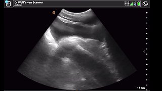 Dr Wolf Performs Ultrasound on Patients Hard Cock