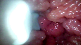 Endoscope Camera Records My Wife's G Spot. Educational Video Close up